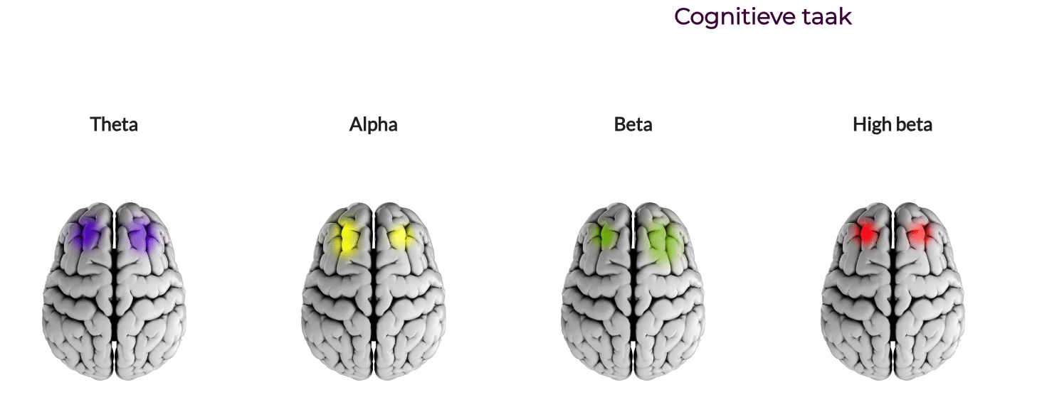 neurofeedback 1